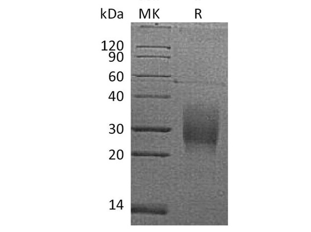 Mouse TRAIL R2/TNFRSF10B Recombinant Protein (RPES2387)