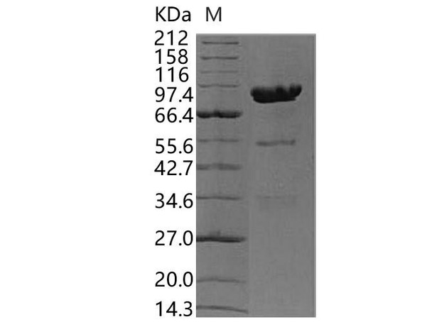 Human Carboxypeptidase E/CPE Recombinant Protein (RPES2390)