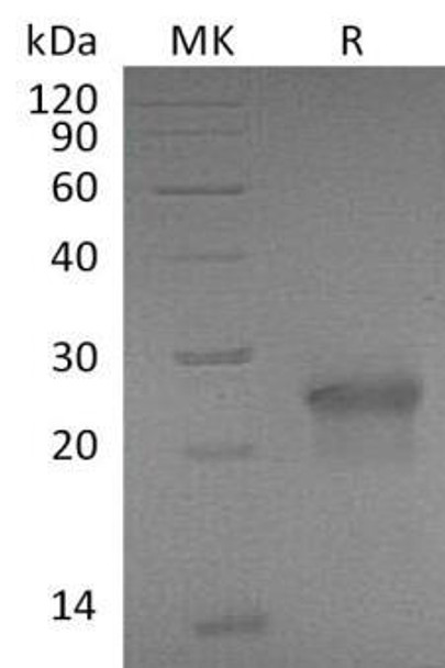 Mouse XEDAR/EDA2R Recombinant Protein (RPES2392)