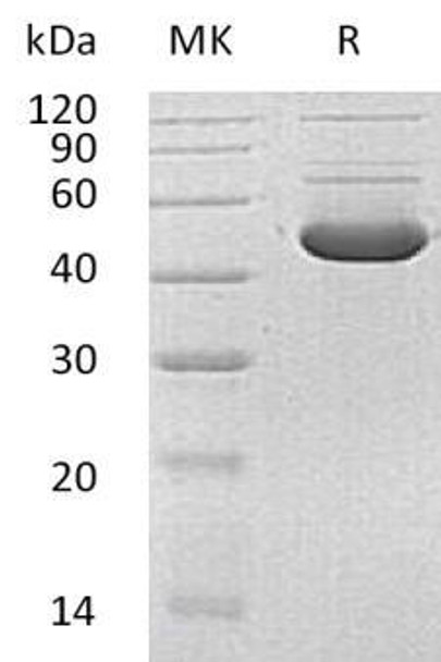 Human HMBS Recombinant Protein (RPES2398)