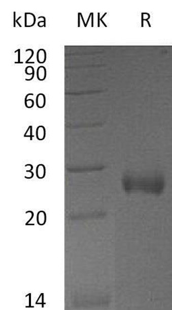 Mouse NBL1/DAND1 Recombinant Protein (RPES2401)