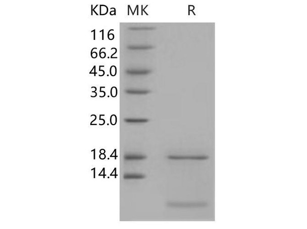Human S100A6 Recombinant Protein (RPES2460)