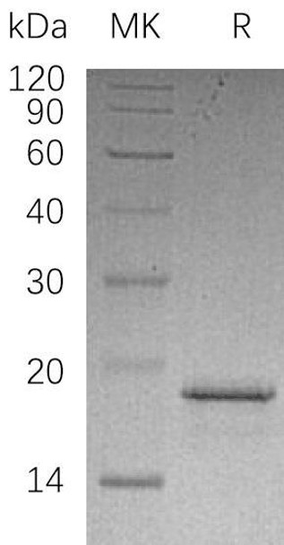 Human PFDN2 Recombinant Protein (RPES2464)