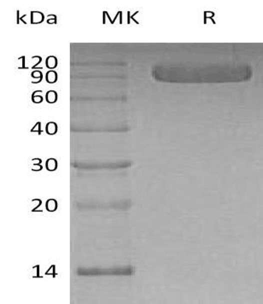 Human Vasorin/VASN Recombinant Protein (RPES2465)