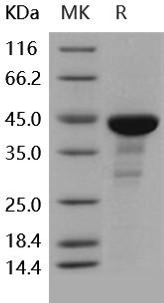 Human CDC42/G25K Recombinant Protein (RPES2476)
