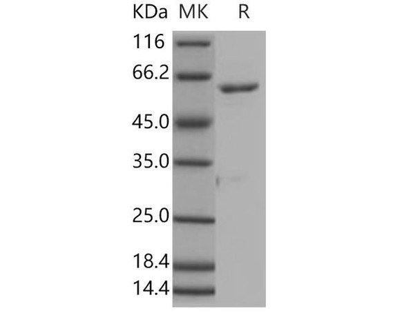 Human ROR1 Recombinant Protein (RPES2479)