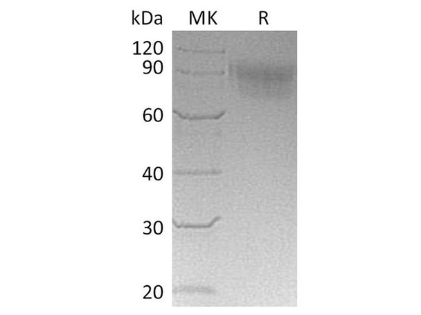 Cynomolgus SIGLEC5/CD170 Recombinant Protein (RPES2492)