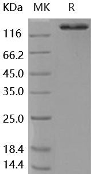 Human ACE2 Recombinant Protein (RPES2493)