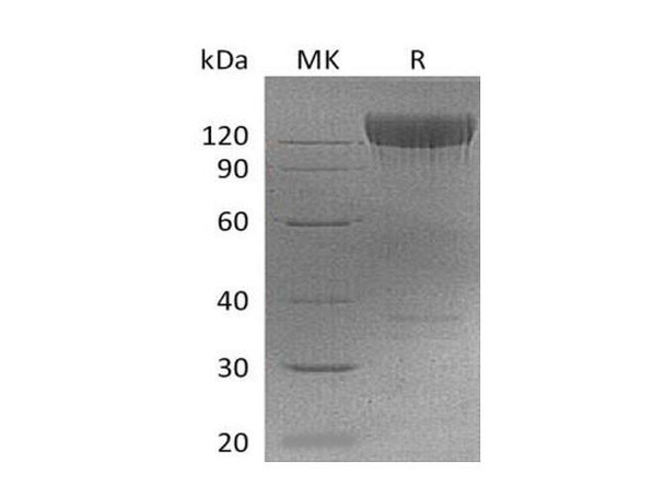 Mouse PDGFRa/CD140a Recombinant Protein (RPES2506)