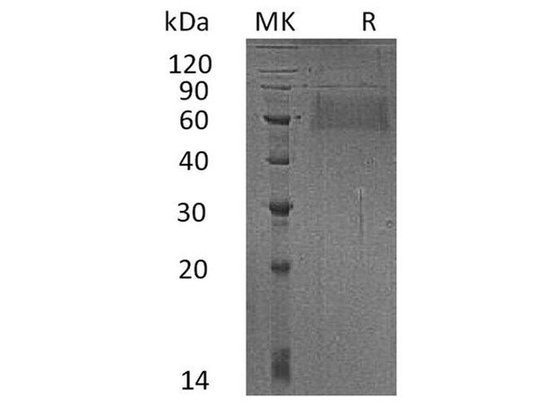 Human SELL Recombinant Protein (RPES2509)