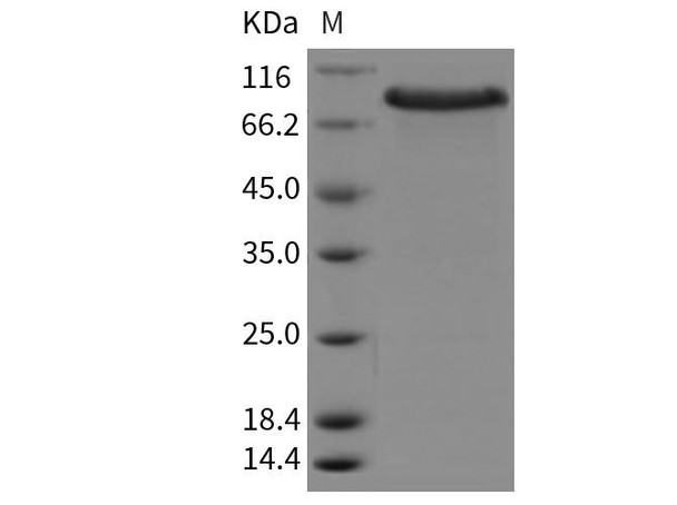 Mouse CRELD1 Recombinant Protein (RPES2516)