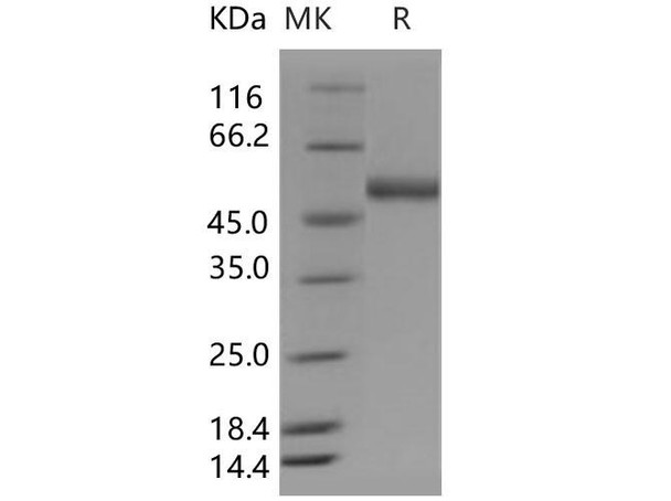 Human ENTPD3/NTPDase3/CD39L3 Recombinant Protein (RPES2519)