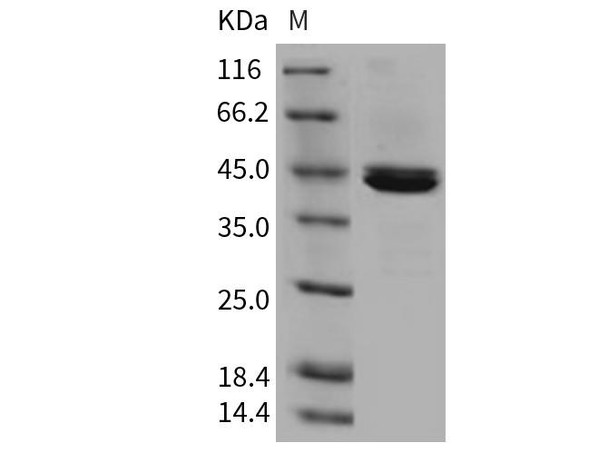 Mouse CPB1 Recombinant Protein (RPES2536)