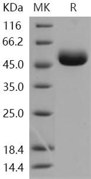 Human Carboxypeptidase M/CPM Recombinant Protein (RPES2552)