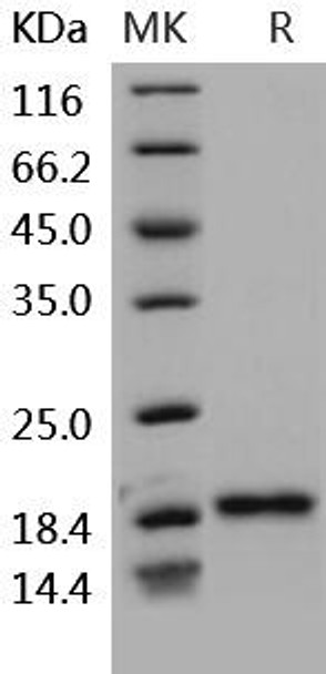 Human BLyS/TNFSF13B/BAFF Recombinant Protein  (RPES2575)