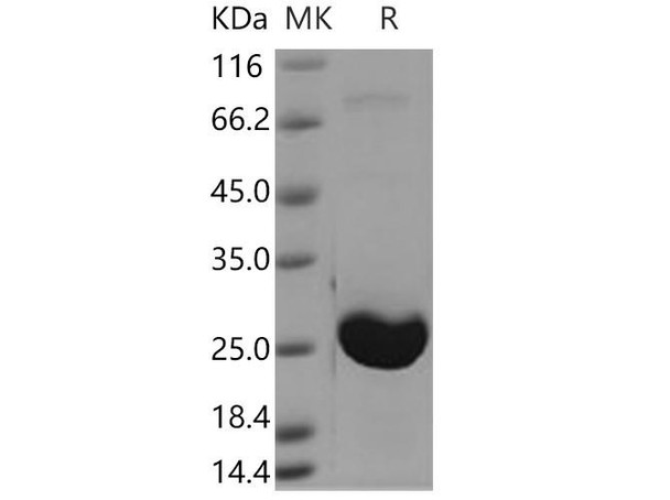 Human AK1/Adenylate kinase 1 Recombinant Protein (RPES2578)