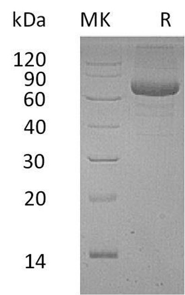 Human PSG9/PSBG9 Recombinant Protein (RPES2583)