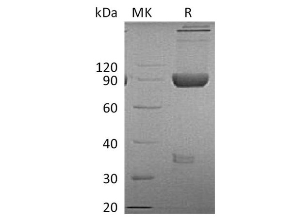 Cynomolgus LAG-3/CD223 Recombinant Protein (RPES2592)