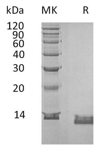 Human IL-8/CXCL8 Recombinant Protein (RPES2604)