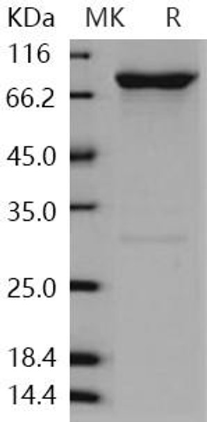 Human GRK6/GPRK6 Recombinant Protein (RPES2620)