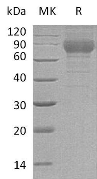 Mouse TEM7R/PLXDC2 Recombinant Protein (RPES2628)