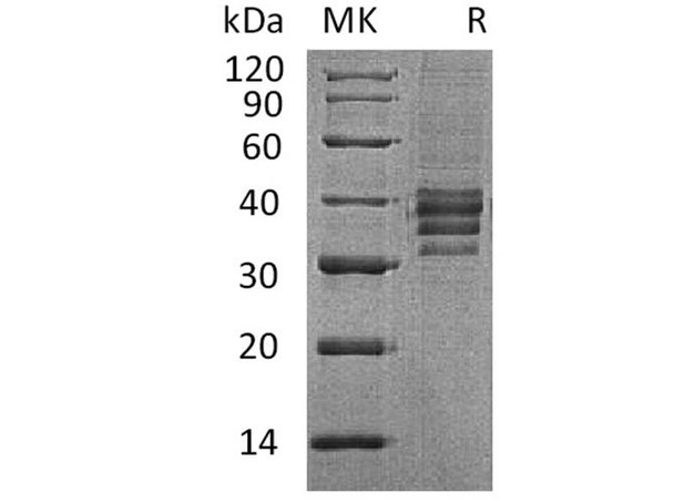 Human Follistatin 288/FST Recombinant Protein (RPES2632)
