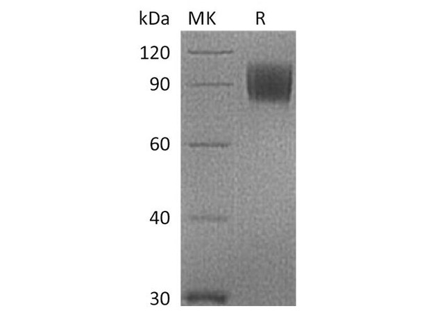 Cynomolgus B7-2/CD86 Recombinant Protein (RPES2633)