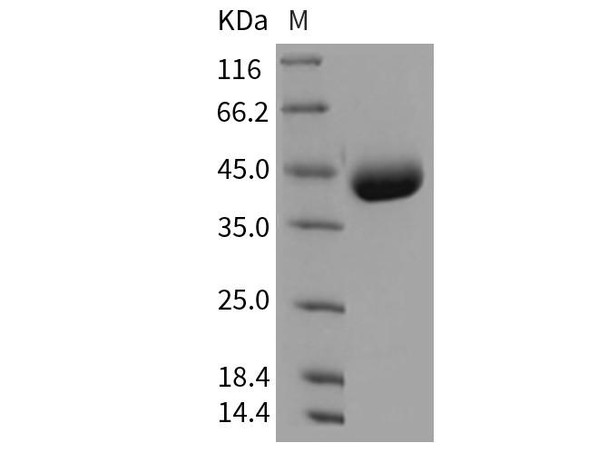 Mouse IL17BR/IL17RB Recombinant Protein (RPES2638)