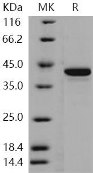 Human STK10/LOK Recombinant Protein (RPES2640)