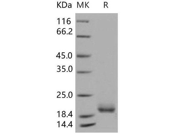 LAIR2/CD306 Recombinant Protein, Low Endotoxin (RPES2641)