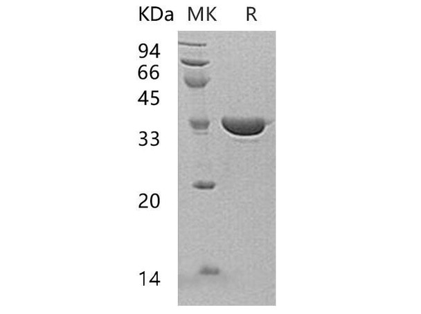 Human Annexin A13/ANXA13 Recombinant Protein (RPES2642)