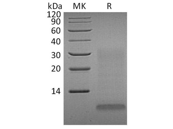 Human INSL4 Recombinant Protein (RPES2643)