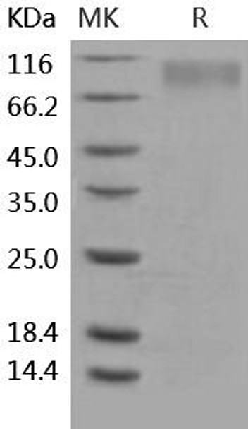 Human TrkC/NTRK3 Recombinant Protein (RPES2659)
