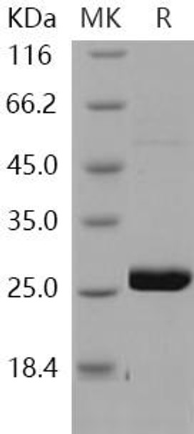 Human METTL11A Recombinant Protein (RPES2678)