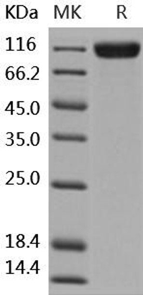Human TrkC/NTRK3 Recombinant Protein (RPES2680)