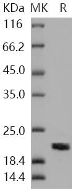 Human NME1/NDKA Recombinant Protein (RPES2683)