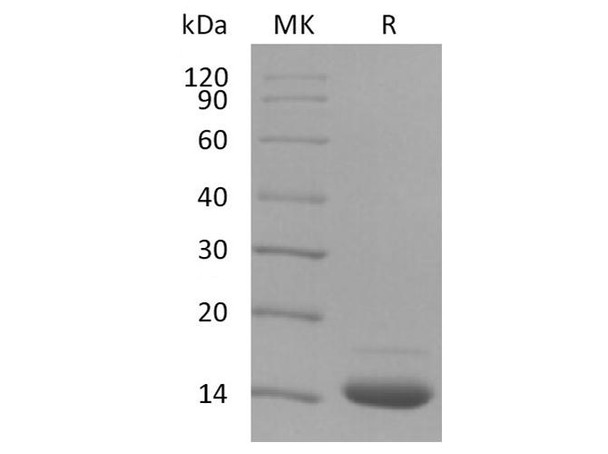 Human Fibronectin/FN Recombinant Protein (RPES2695)