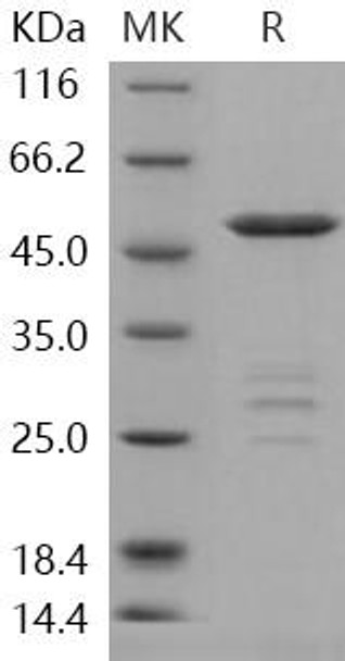 Human METTL11A Recombinant Protein (RPES2699)