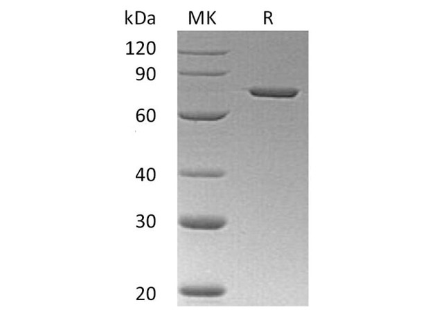 Human Annexin A6/ANXA6 Recombinant Protein (RPES2706)