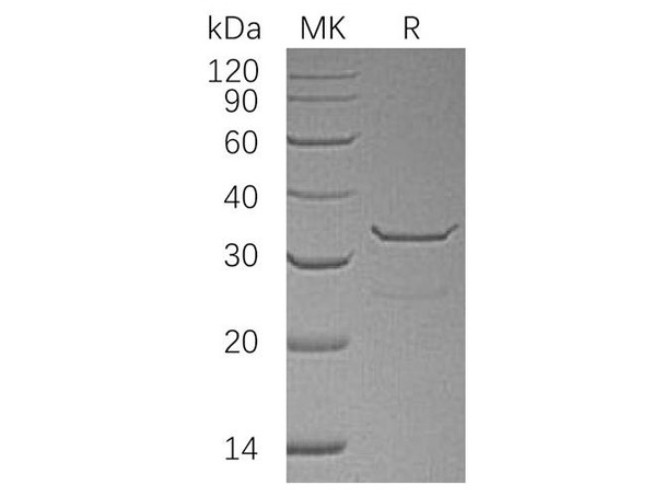 Human SULT1B1 Recombinant Protein (RPES2715)