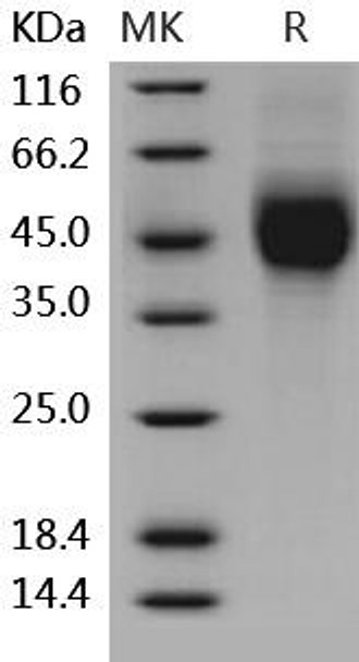 Human 2B4/CD244 Recombinant Protein (RPES2722)