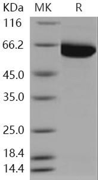 Human PAK3 Recombinant Protein (RPES2725)