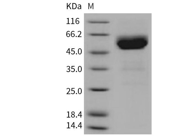 Mouse TRAIL R2/TNFRSF10B Recombinant Protein (RPES2752)
