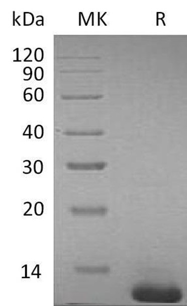 Mouse S100B Recombinant Protein (RPES2753)