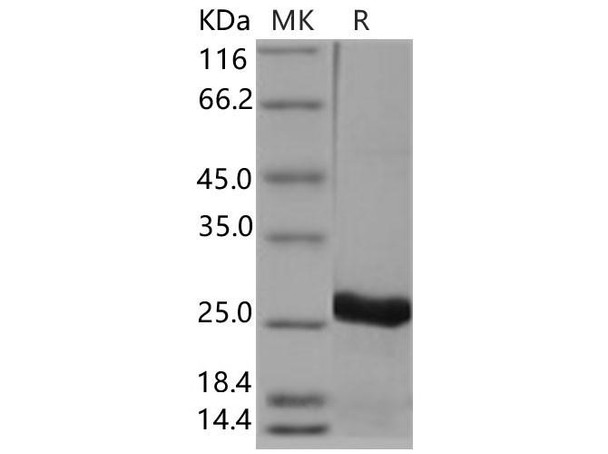 Human UBE2T Recombinant Protein (RPES2760)