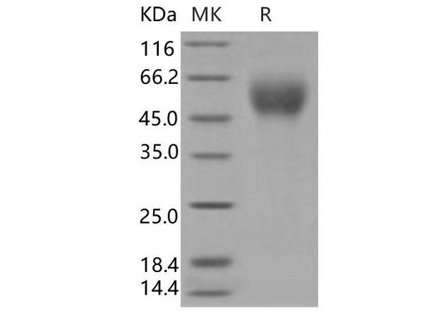 Human CD200R1 Recombinant Protein (RPES2761)