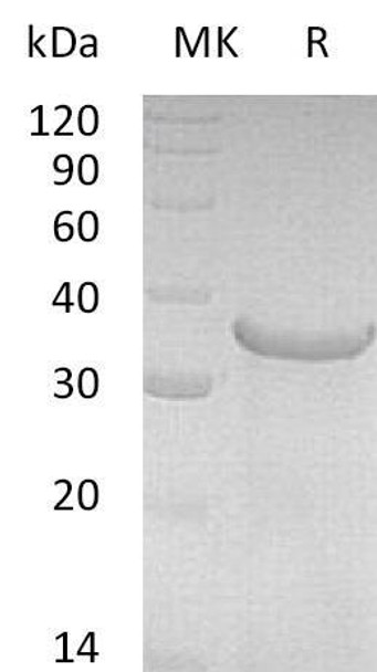 Pro-Neuregulin/NRG1-beta 1 Recombinant Protein (RPES2769)