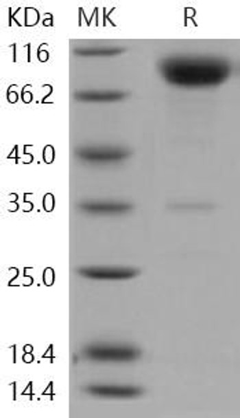 Human CD200R1 Recombinant Protein (RPES2779)