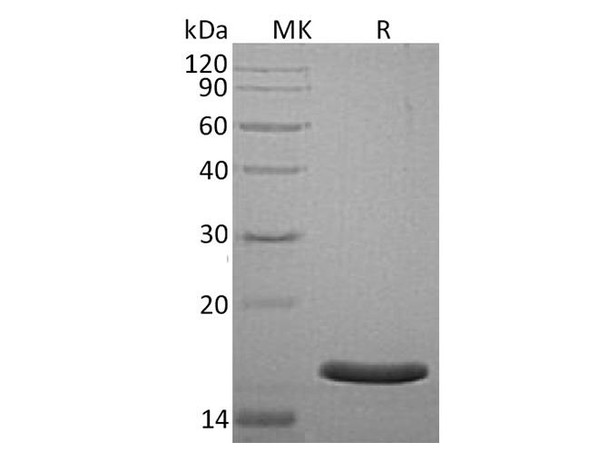 Human AGR3 Recombinant Protein (RPES2785)