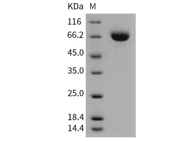 Mouse Endoglin/CD105 Recombinant Protein (RPES2790)